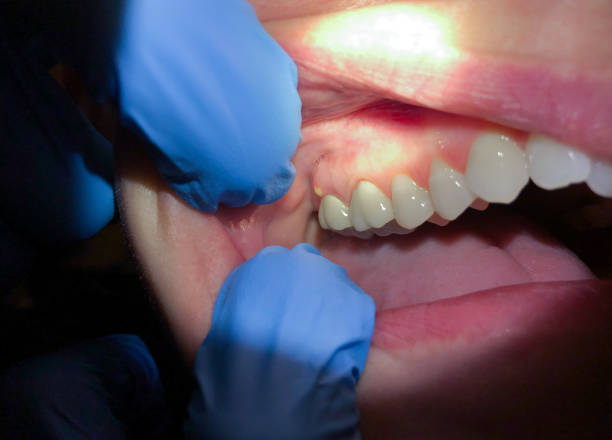 Best Pediatric Emergency Dentist in Gahanna, OH