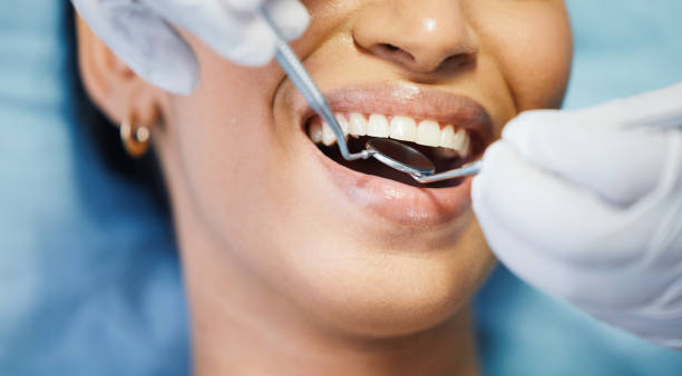 Best Mobile Emergency Dentist in Gahanna, OH